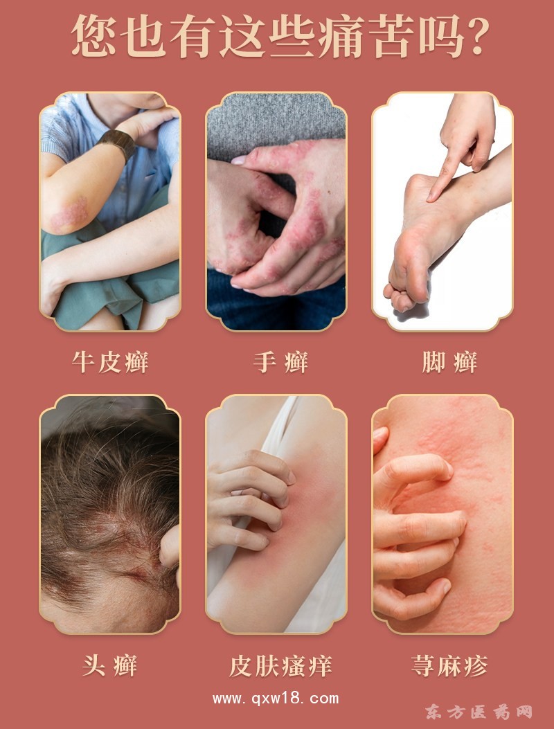 導(dǎo)光凝膠灸熱泥泥灸批發(fā)代理定制定做醫(yī)院診所 醫(yī)院診所企業(yè)