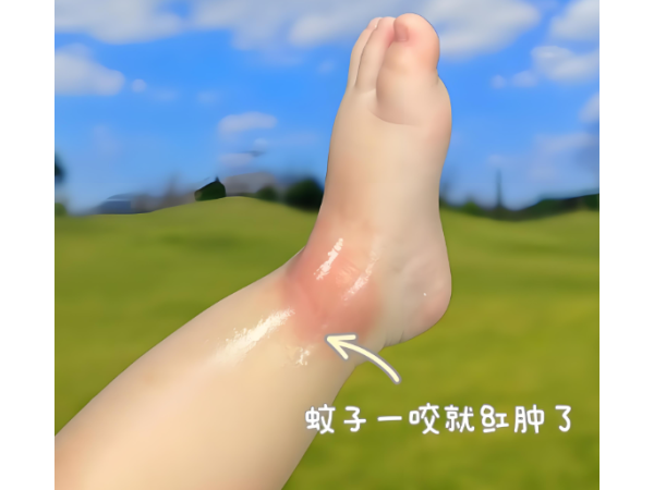 防蚊貼驅(qū)蚊貼片防蚊貼片兒童驅(qū)蚊貼廠家隨身驅(qū)蚊貼現(xiàn)貨戶外防蚊貼驅(qū)蚊貼劑驅(qū)蚊液